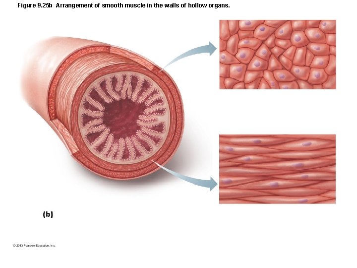 Figure 9. 25 b Arrangement of smooth muscle in the walls of hollow organs. Figure 9. 25 b Arrangement of smooth muscle in the walls of hollow organs.