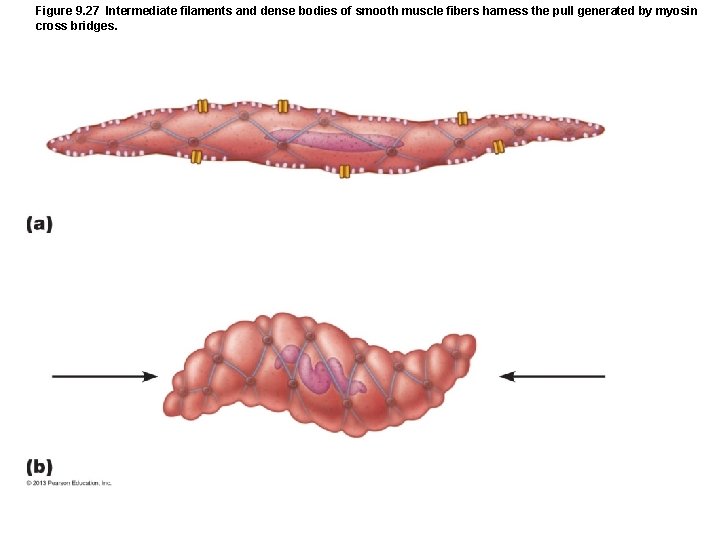 Figure 9. 27 Intermediate filaments and dense bodies of smooth muscle fibers harness the Figure 9. 27 Intermediate filaments and dense bodies of smooth muscle fibers harness the