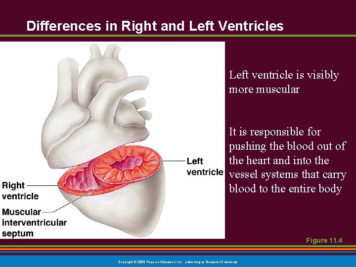 Differences in Right and Left Ventricles Left ventricle is visibly more muscular It is Differences in Right and Left Ventricles Left ventricle is visibly more muscular It is