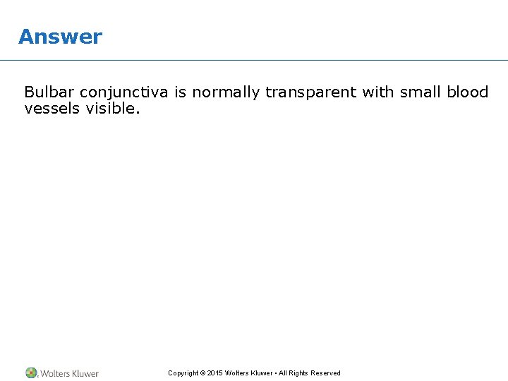 Answer Bulbar conjunctiva is normally transparent with small blood vessels visible. Copyright © 2015