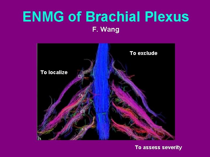 ENMG of Brachial Plexus F. Wang To exclude To localize To assess severity 
