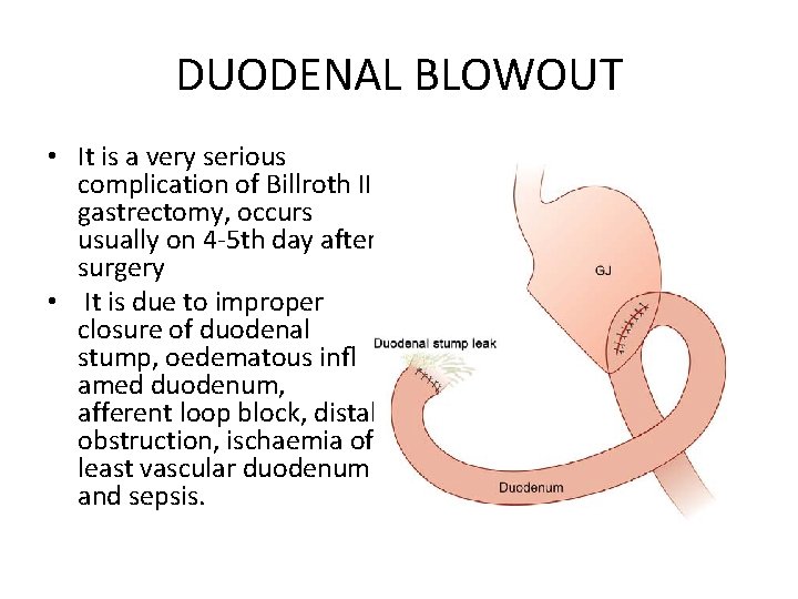 DUODENAL BLOWOUT • It is a very serious complication of Billroth II gastrectomy, occurs