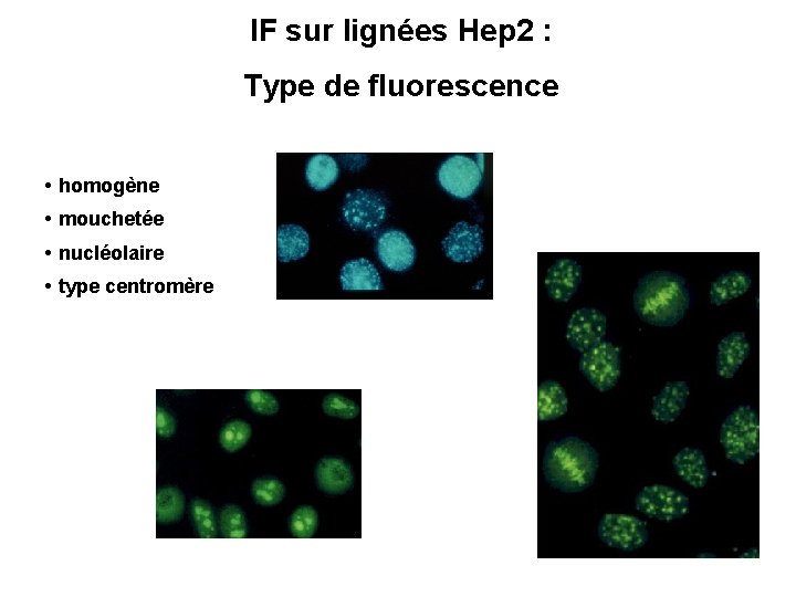 IF sur lignées Hep 2 : Type de fluorescence • homogène • mouchetée •