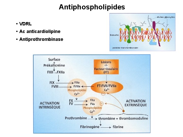 Antiphospholipides • VDRL • Ac anticardiolipine • Antiprothrombinase 