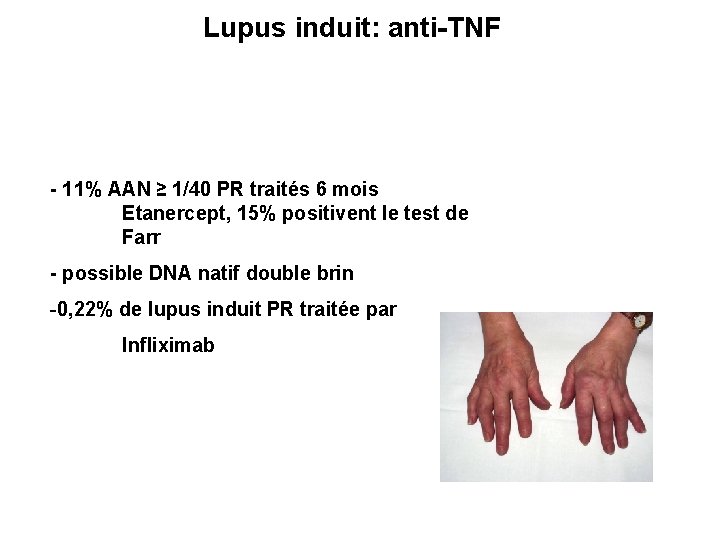 Lupus induit: anti-TNF - 11% AAN ≥ 1/40 PR traités 6 mois Etanercept, 15%