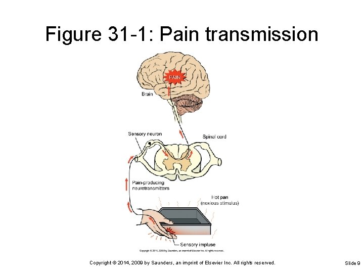 Figure 31 -1: Pain transmission Copyright © 2014, 2009 by Saunders, an imprint of