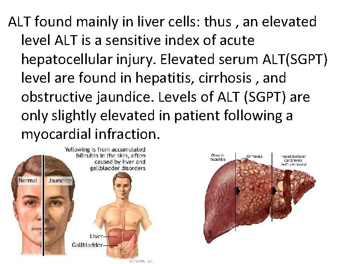ALT found mainly in liver cells: thus , an elevated level ALT is a