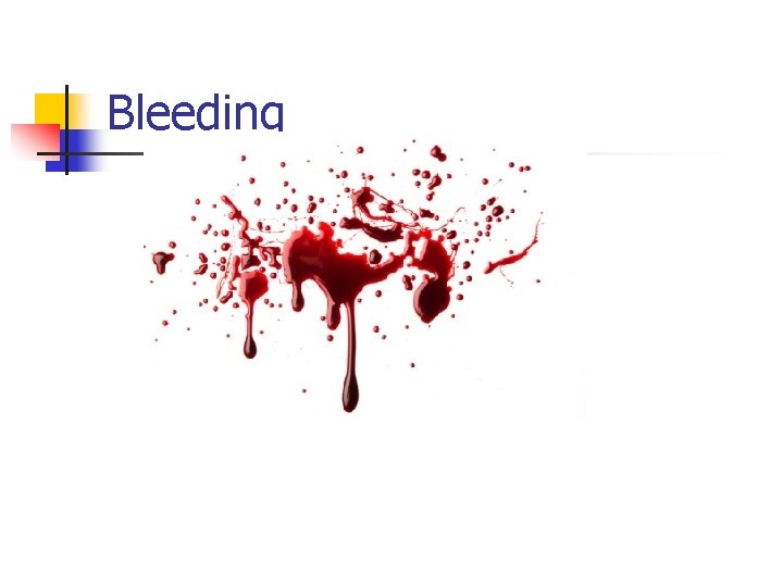 Bleeding 
