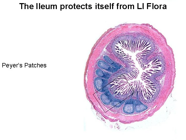 The Ileum protects itself from LI Flora Peyer’s Patches 