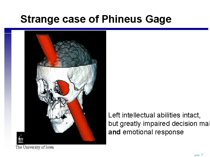 Strange case of Phineus Gage Left intellectual abilities intact, but greatly impaired decision mak