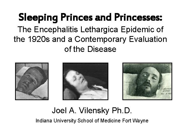 Sleeping Princes and Princesses: The Encephalitis Lethargica Epidemic of the 1920 s and a