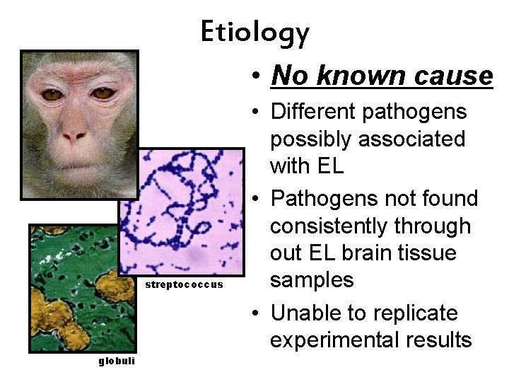 Etiology • No known cause streptococcus globuli • Different pathogens possibly associated with EL