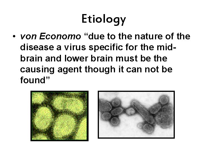 Etiology • von Economo “due to the nature of the disease a virus specific