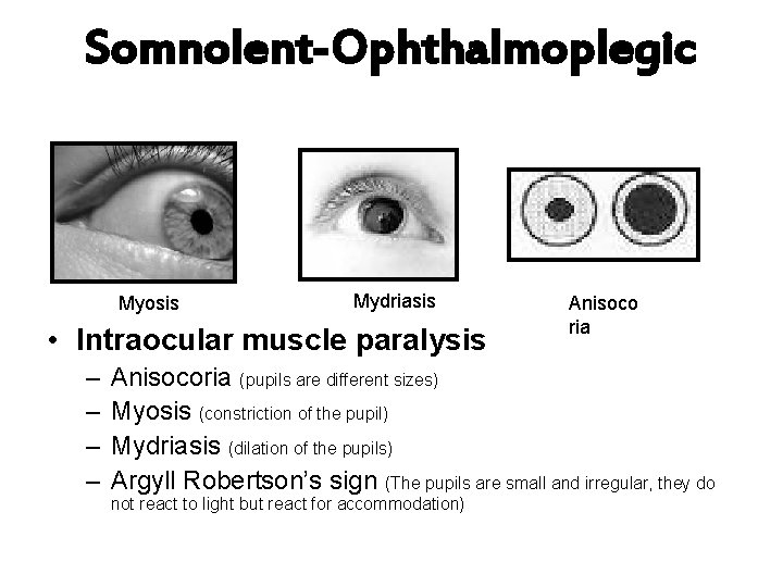 Somnolent-Ophthalmoplegic Myosis Mydriasis • Intraocular muscle paralysis – – Anisoco ria Anisocoria (pupils are