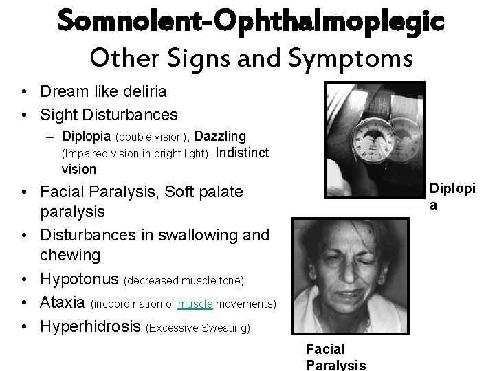 Somnolent-Ophthalmoplegic Other Signs and Symptoms • Dream like deliria • Sight Disturbances – Diplopia