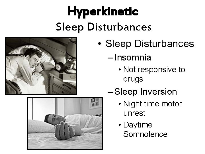 Hyperkinetic Sleep Disturbances • Sleep Disturbances – Insomnia • Not responsive to drugs –