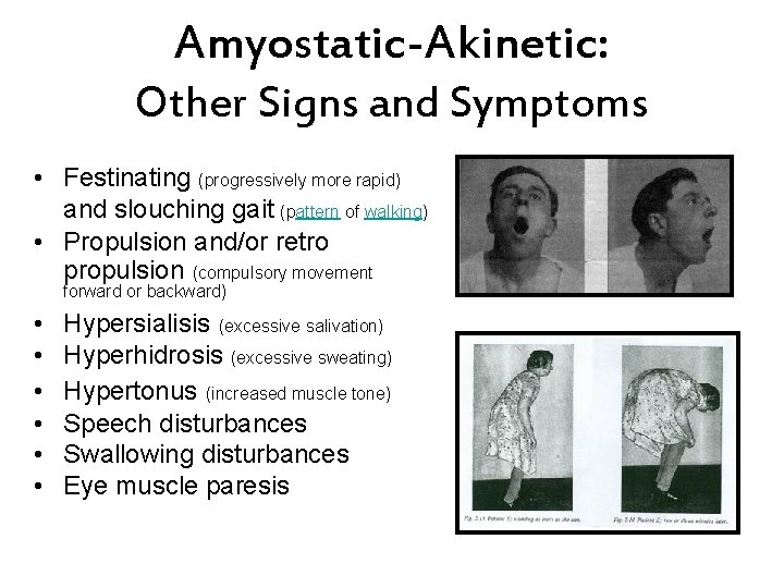 Amyostatic-Akinetic: Other Signs and Symptoms • Festinating (progressively more rapid) and slouching gait (pattern