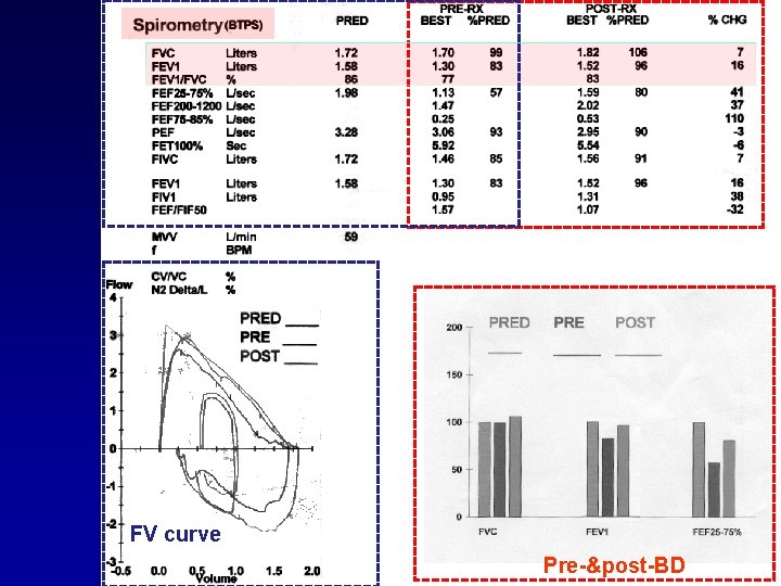 FV curve Pre-&post-BD 