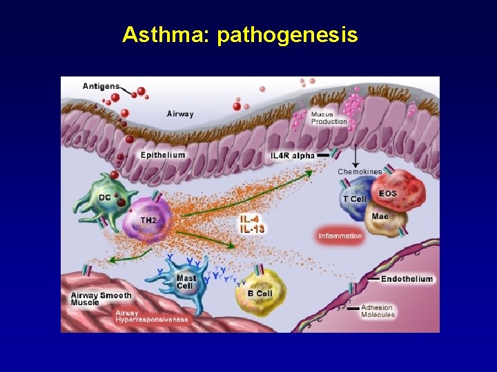 Asthma: pathogenesis 