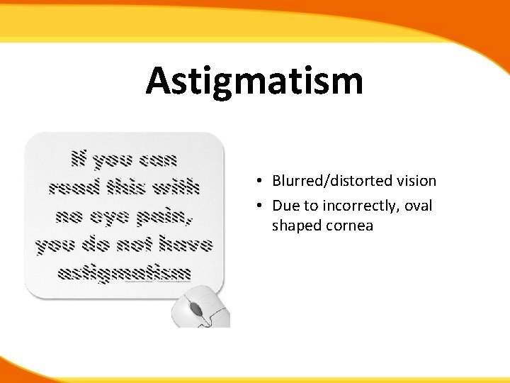 Astigmatism • Blurred/distorted vision • Due to incorrectly, oval shaped cornea 