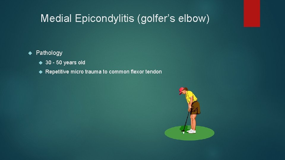 Medial Epicondylitis (golfer’s elbow) Pathology 30 - 50 years old Repetitive micro trauma to