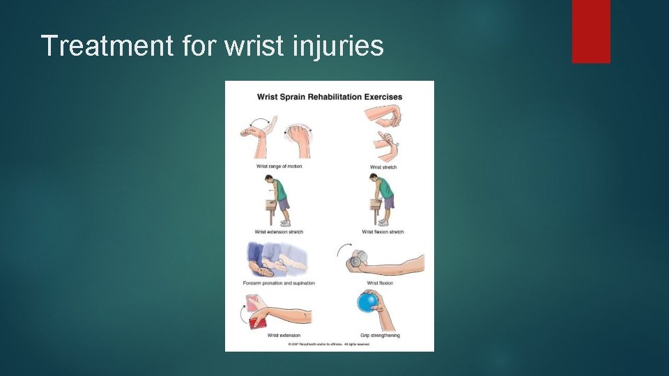 Treatment for wrist injuries 