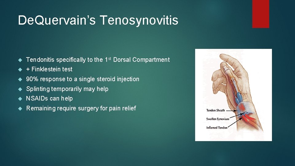 De. Quervain’s Tenosynovitis Tendonitis specifically to the 1 st Dorsal Compartment + Finklestein test