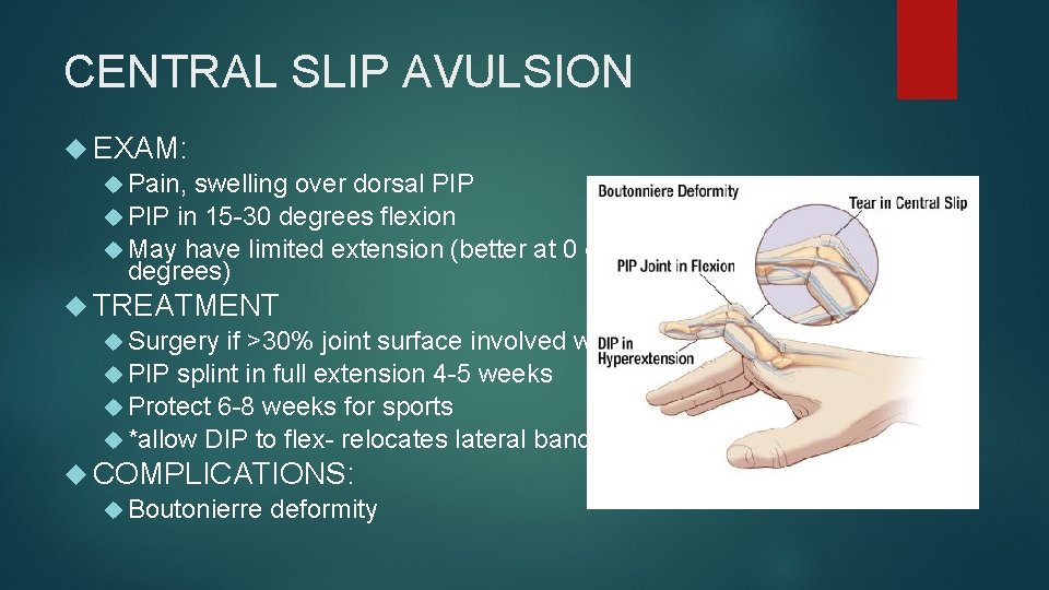 CENTRAL SLIP AVULSION EXAM: Pain, swelling over dorsal PIP in 15 -30 degrees flexion