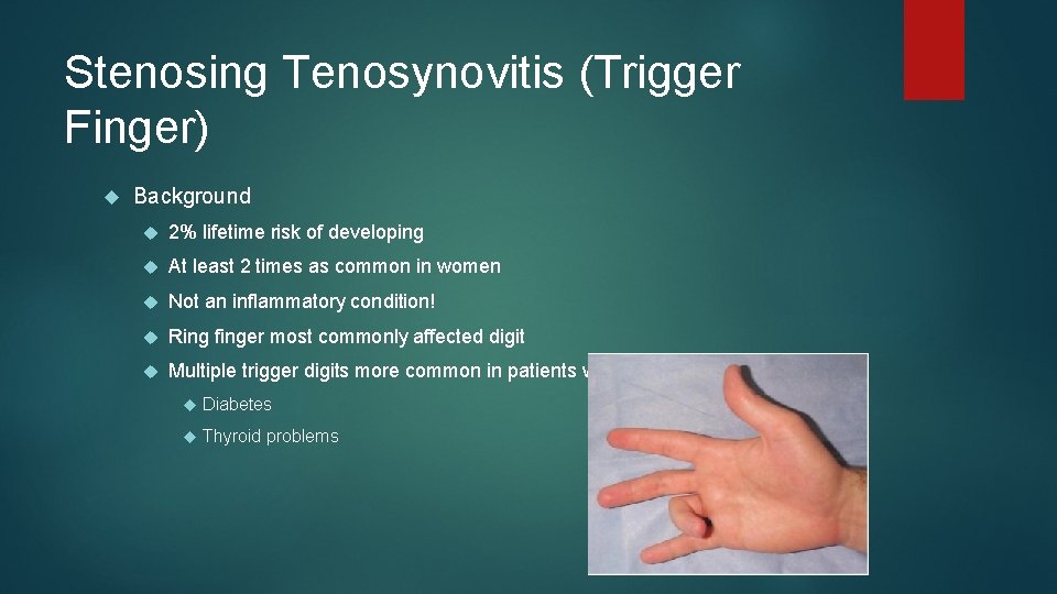 Stenosing Tenosynovitis (Trigger Finger) Background 2% lifetime risk of developing At least 2 times