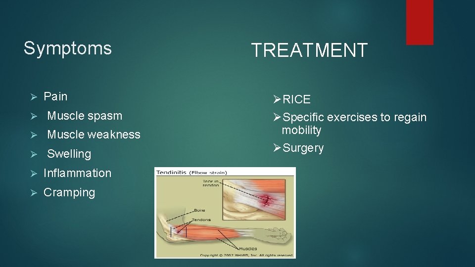 Symptoms Ø Pain Ø Muscle spasm Ø Muscle weakness Ø Swelling Ø Inflammation Ø