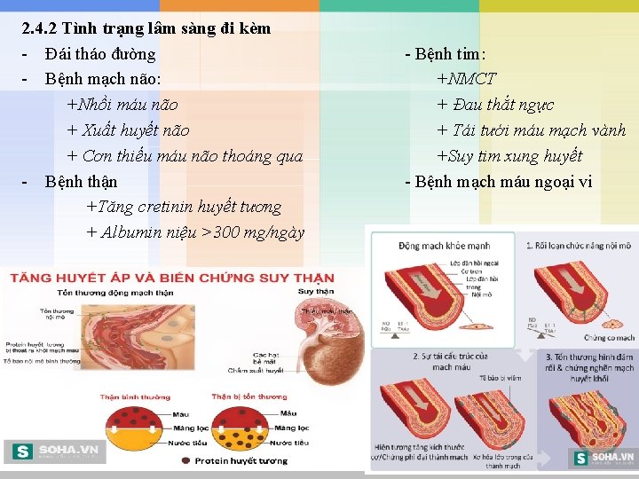 2. 4. 2 Tình trạng lâm sàng đi kèm - Đái tháo đường -