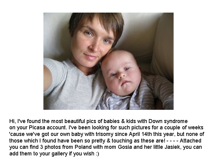 Hi, I've found the most beautiful pics of babies & kids with Down syndrome Hi, I've found the most beautiful pics of babies & kids with Down syndrome