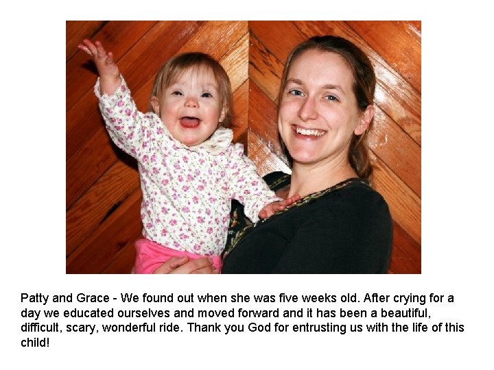 Patty and Grace We found out when she was five weeks old. After crying Patty and Grace We found out when she was five weeks old. After crying