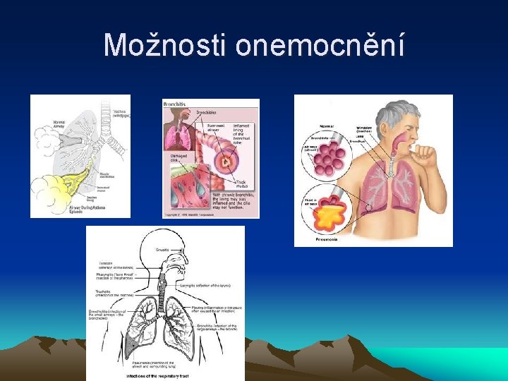 Možnosti onemocnění 