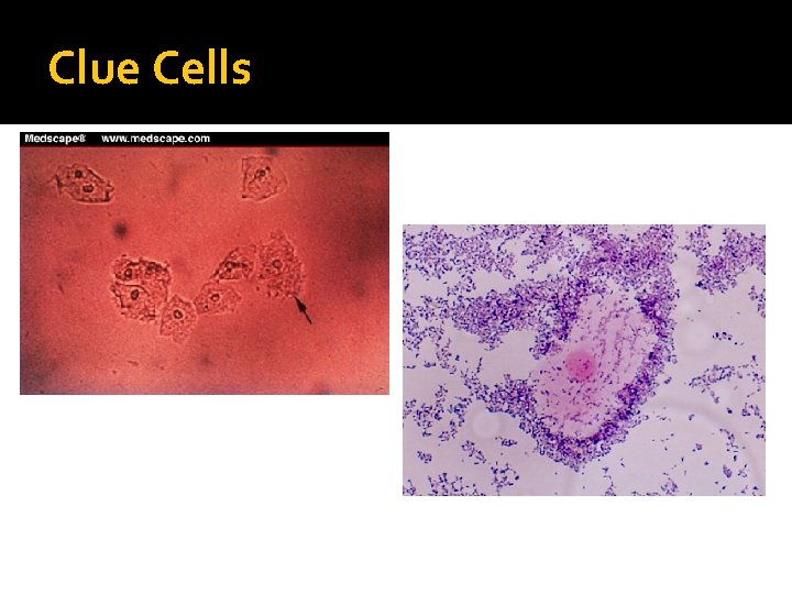 Clue Cells Clue Cells