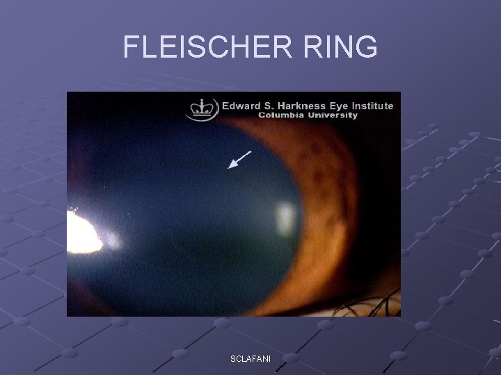 FLEISCHER RING SCLAFANI 