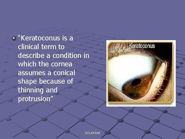 “Keratoconus is a clinical term to describe a condition in which the cornea assumes