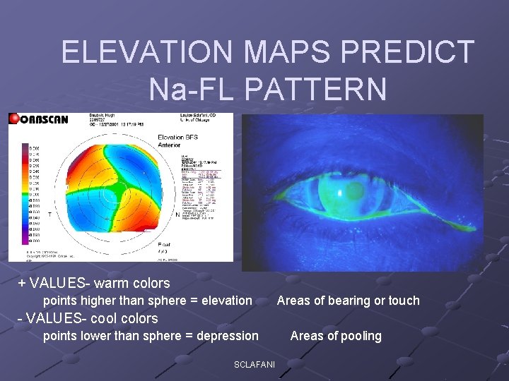 ELEVATION MAPS PREDICT Na-FL PATTERN + VALUES- warm colors points higher than sphere =