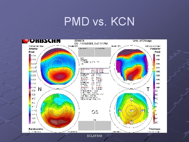 PMD vs. KCN SCLAFANI 