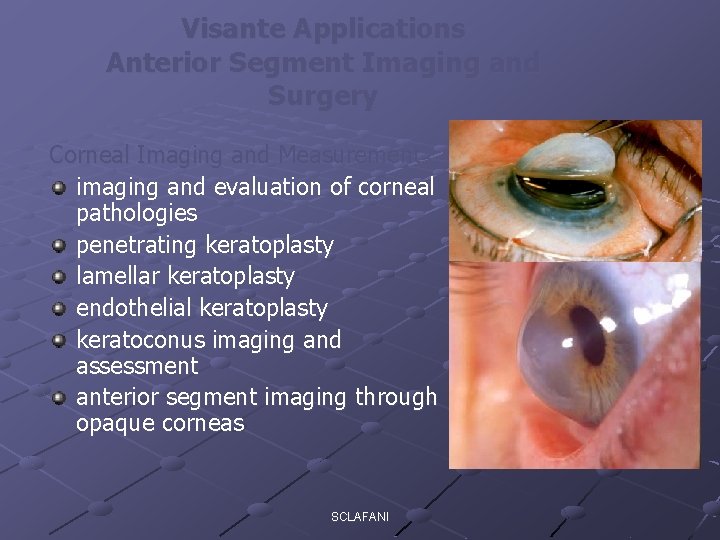 Visante Applications Anterior Segment Imaging and Surgery Corneal Imaging and Measurement imaging and evaluation