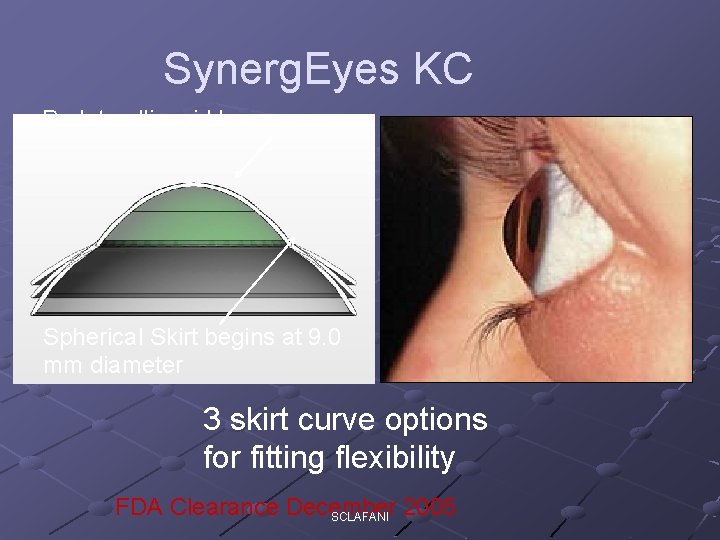 Synerg. Eyes KC Prolate ellipsoid base curve Spherical Skirt begins at 9. 0 mm