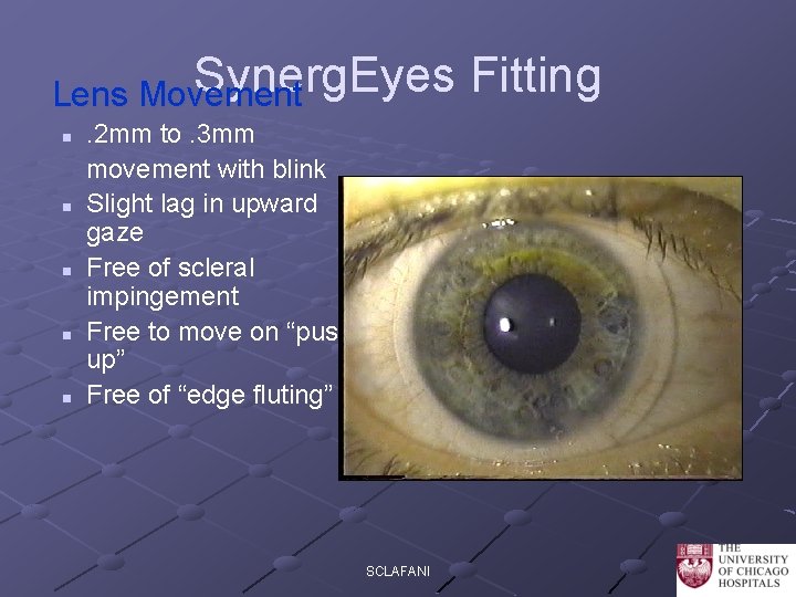 Synerg. Eyes Lens Movement n n n . 2 mm to. 3 mm movement