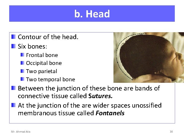 b. Head Contour of the head. Six bones: Frontal bone Occipital bone Two parietal