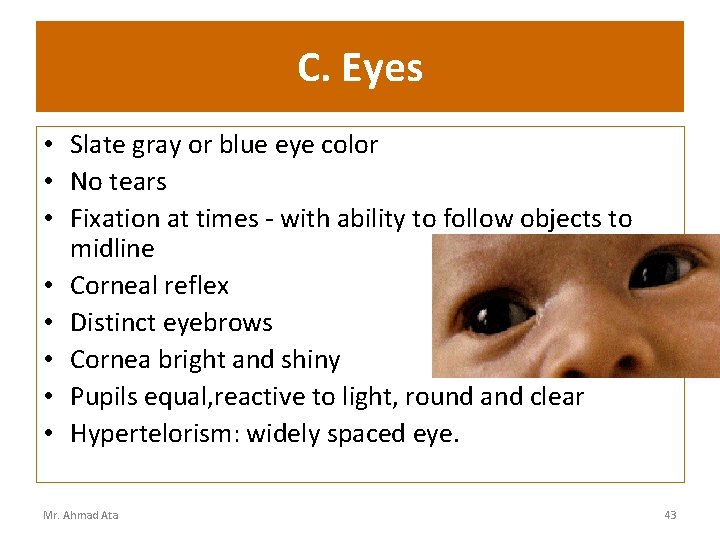 C. Eyes • Slate gray or blue eye color • No tears • Fixation
