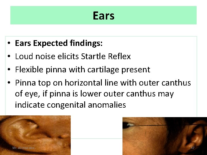 Ears • • Ears Expected findings: Loud noise elicits Startle Reflex Flexible pinna with