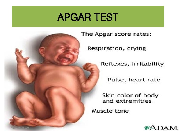 APGAR TEST Mr. Ahmad Ata 75 