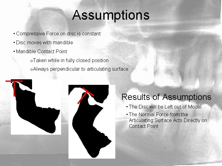 Assumptions • Compressive Force on disc is constant • Disc moves with mandible •