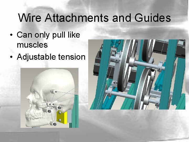 Wire Attachments and Guides • Can only pull like muscles • Adjustable tension 