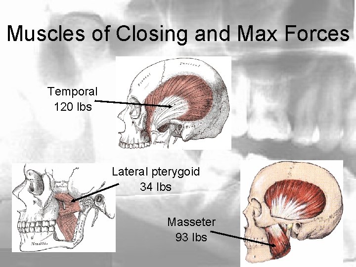 Muscles of Closing and Max Forces Temporal 120 lbs Lateral pterygoid 34 lbs Masseter