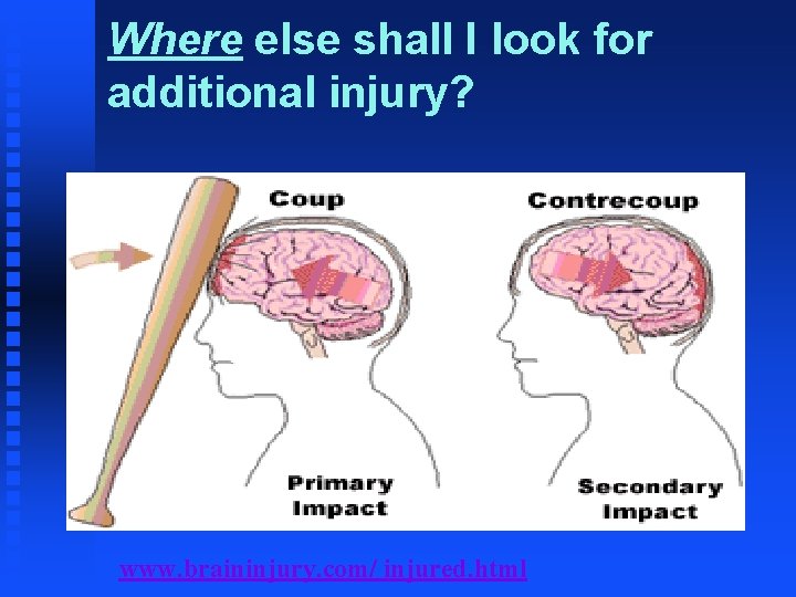 Where else shall I look for additional injury? www. braininjury. com/ injured. html 